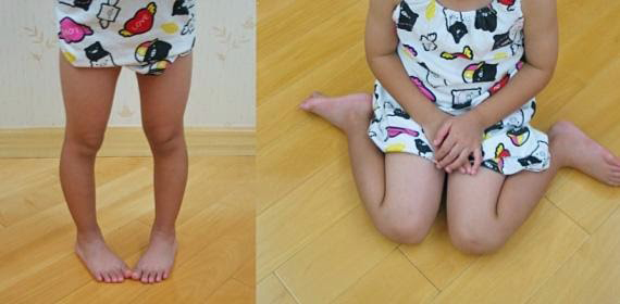 podologo infantil malaga nino puntas dentro sentado w